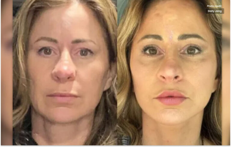 خاتون  نے اپنا گھر کاسمیٹک سرجری کی ادائیگی کے لیے بیچ دیا